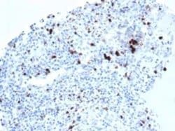 TIA1 Rabbit anti-Human, Clone: TIA1/1352R, Novus Biologicals 20 &mu;g;